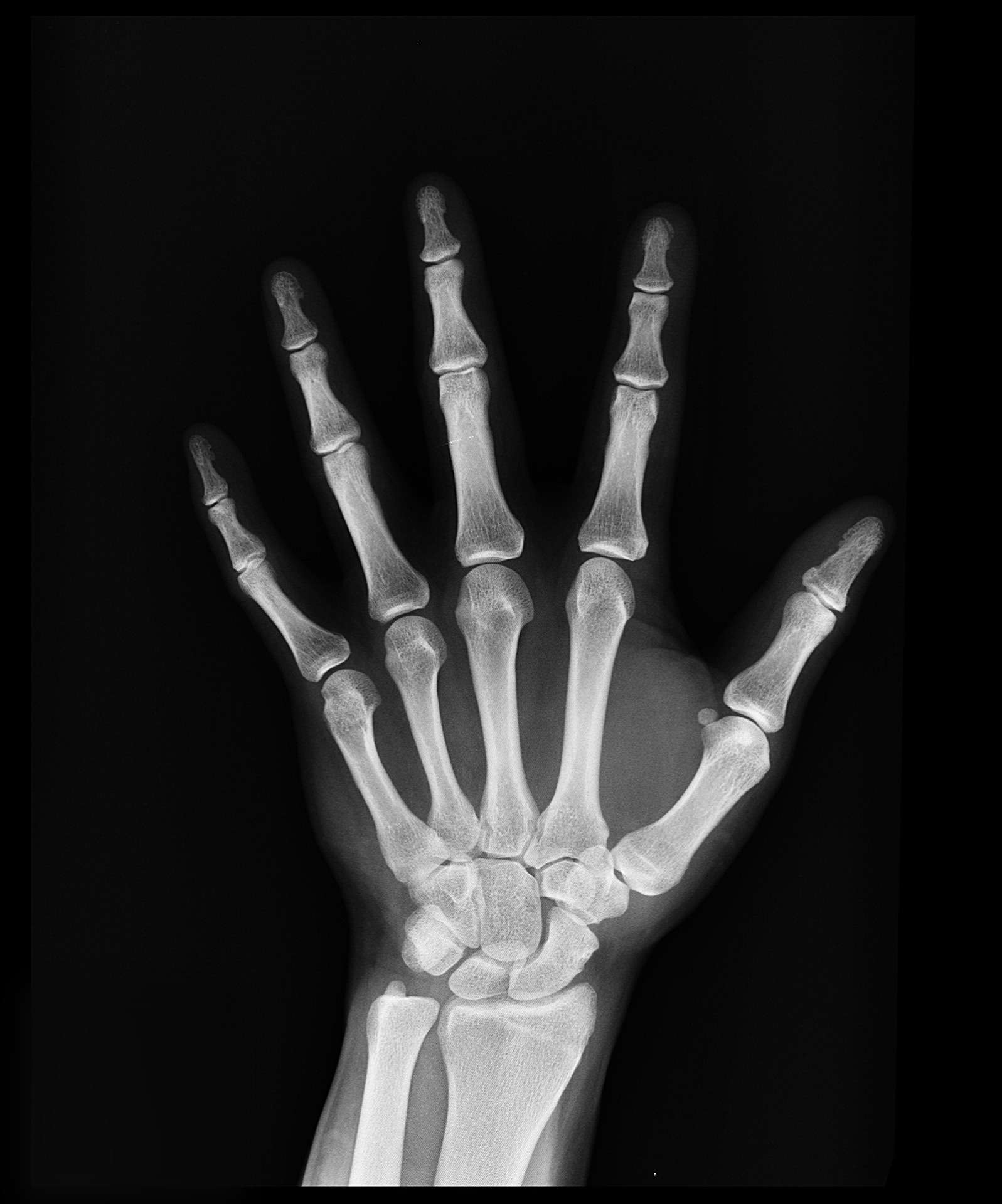 x-ray-1704855_1920